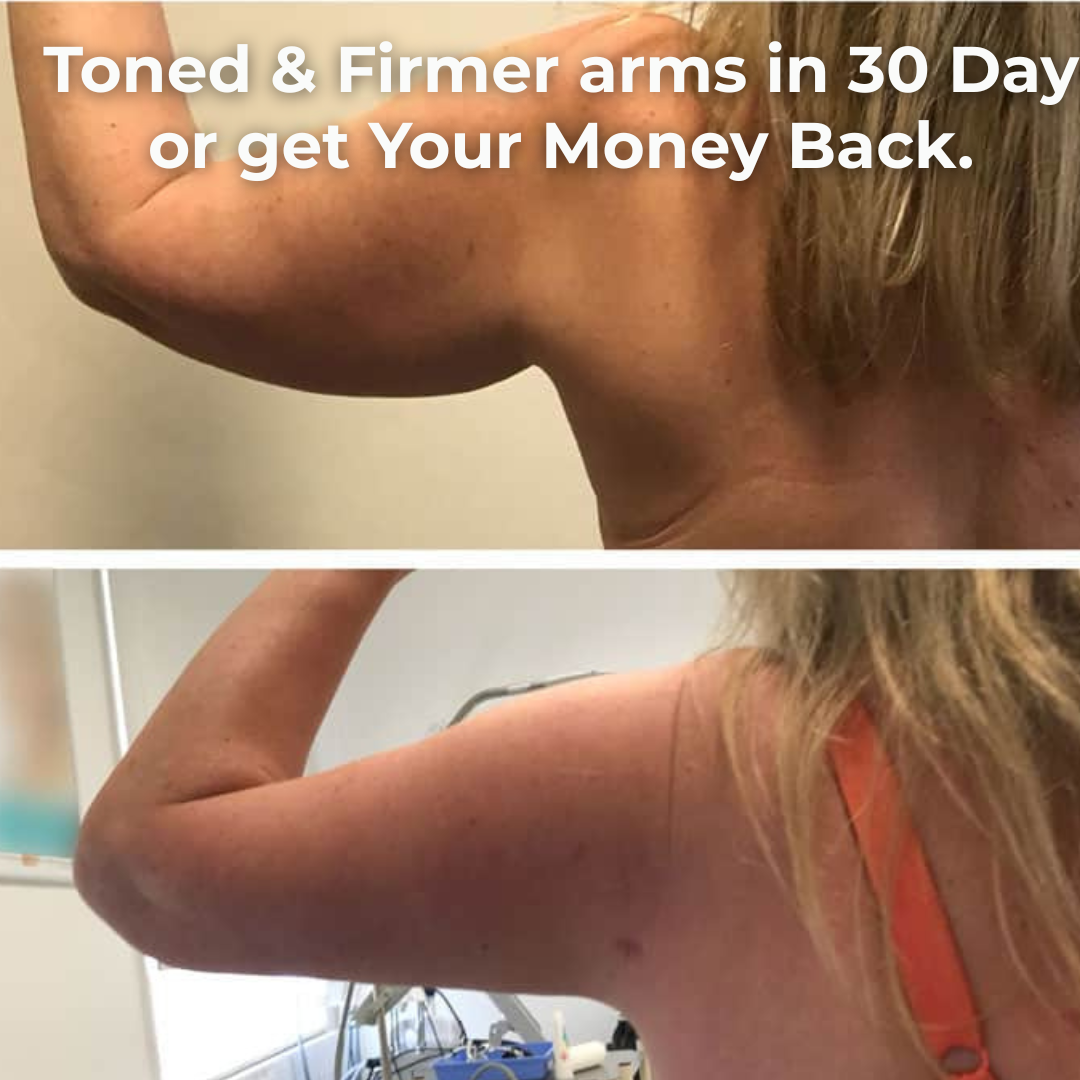 ArmFit Pro - Get rid of flabby arms